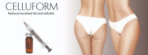 Cellufrom Reduces Localised Fat And Cellulite