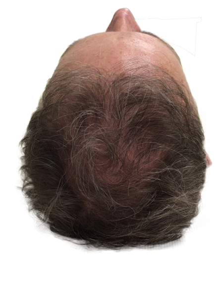Jeremy Hair After